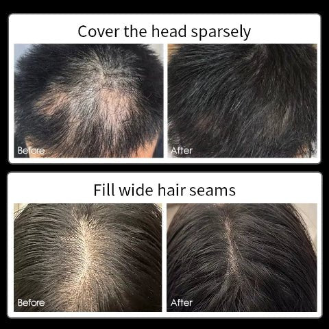 Hair Concealer for Men Waterproof Black Brown Baldness Corrector Cream Thinning Hair Fillup Scalp Dye Beauty Health 40ML