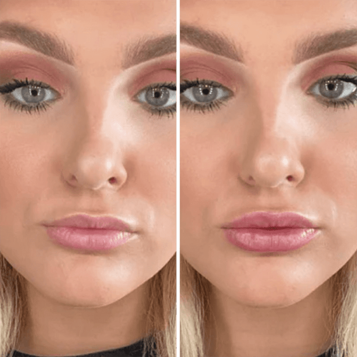 KISSFORM™ - Titanium Lips Booster & Serum - aarwaan