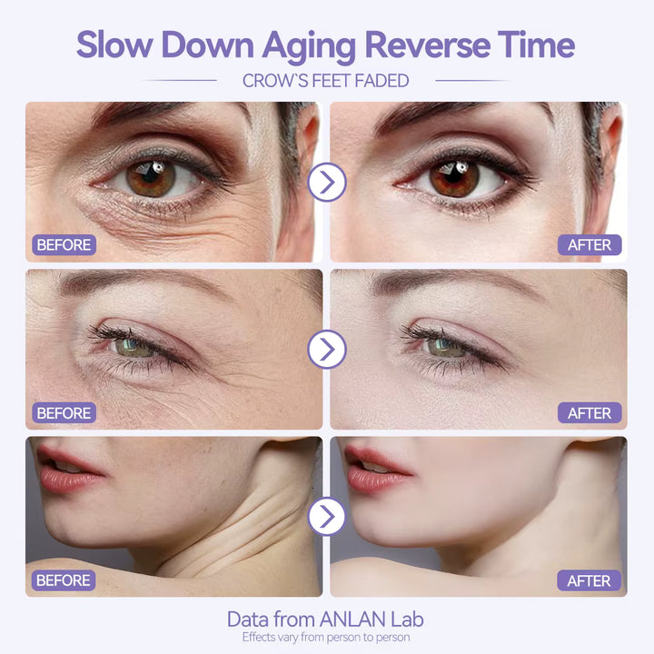 Aarwaan facial massager with LED photon therapy for face lifting and deep skin rejuvenation, shown in close-up image.