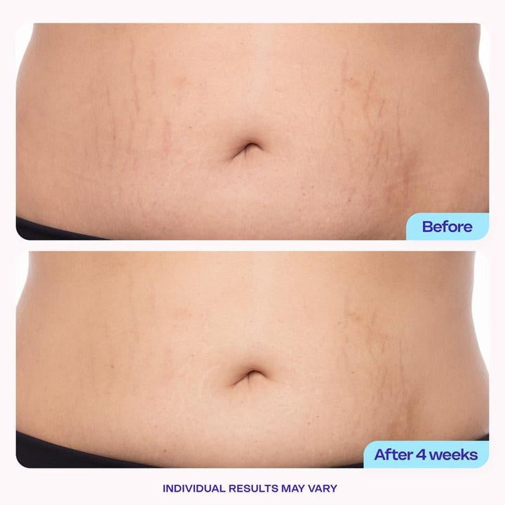 GOPURE Tighten & Smooth Belly Firming Cream