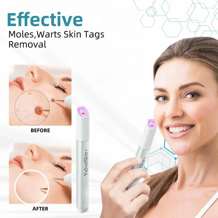 ✨QIAWI™ All-In-One CO₂ Laser Eraser Pen | Removes Moles, Warts, Skin Flaws & Pigmentation