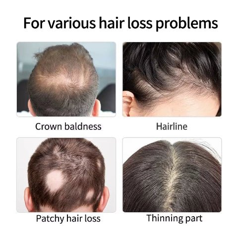 Hair Concealer for Men Waterproof Black Brown Baldness Corrector Cream Thinning Hair Fillup Scalp Dye Beauty Health 40ML