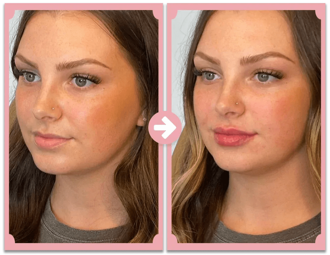 KISSFORM™ - Titanium Lips Booster & Serum - aarwaan