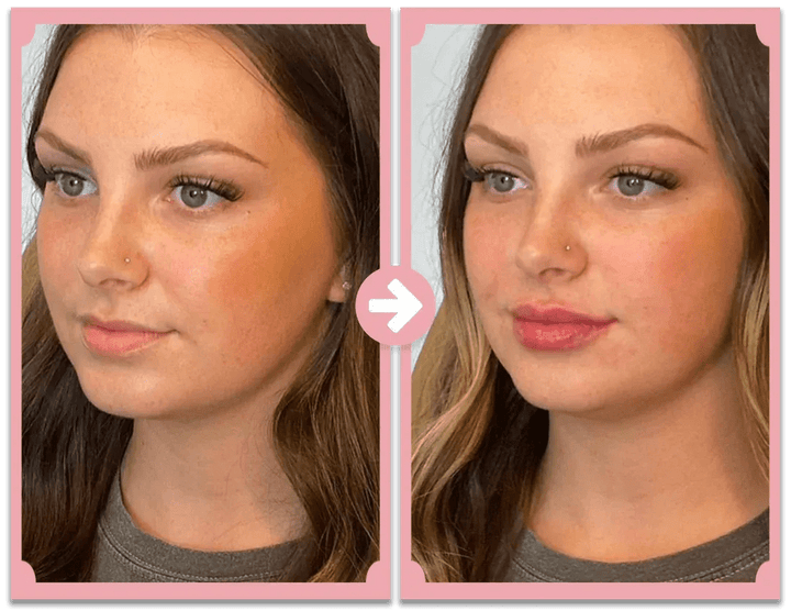 KISSFORM™ - Titanium Lips Booster & Serum - aarwaan