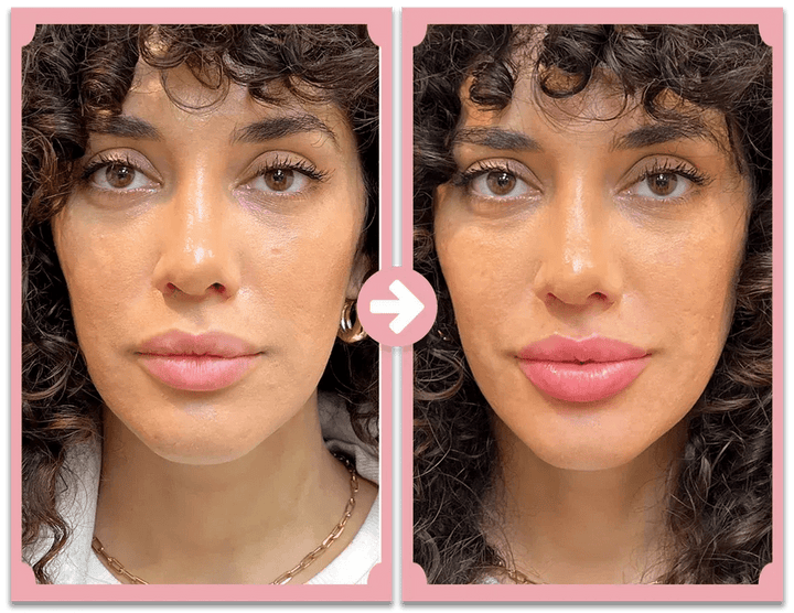 KISSFORM™ - Titanium Lips Booster & Serum - aarwaan